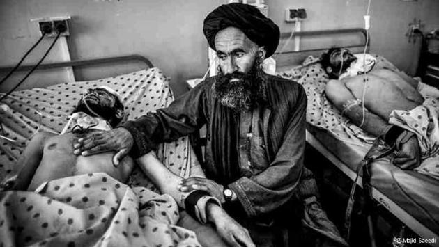 Афганские мужчины в госпитале