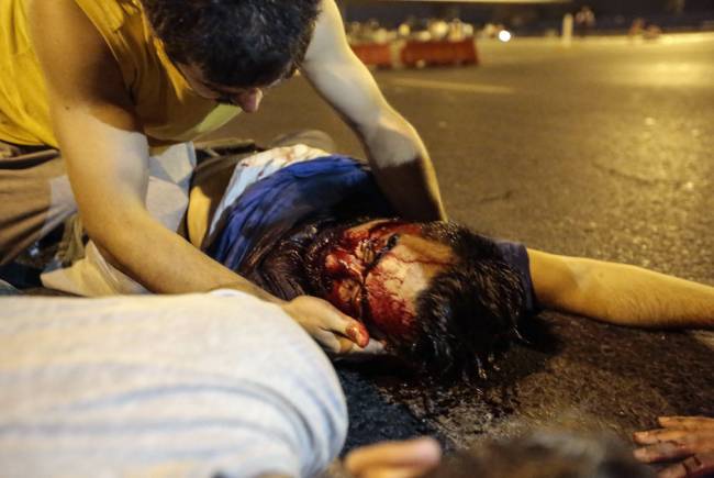 Раненые на одной из улиц Анкары