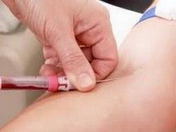 Медики вновь будут делать кровопускание